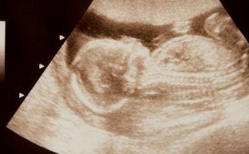 常州市妇幼保健院有吗附试管怀孕价格明细解说？