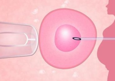 解析选择格鲁吉亚进行第三代试管婴儿的费用影响因素
